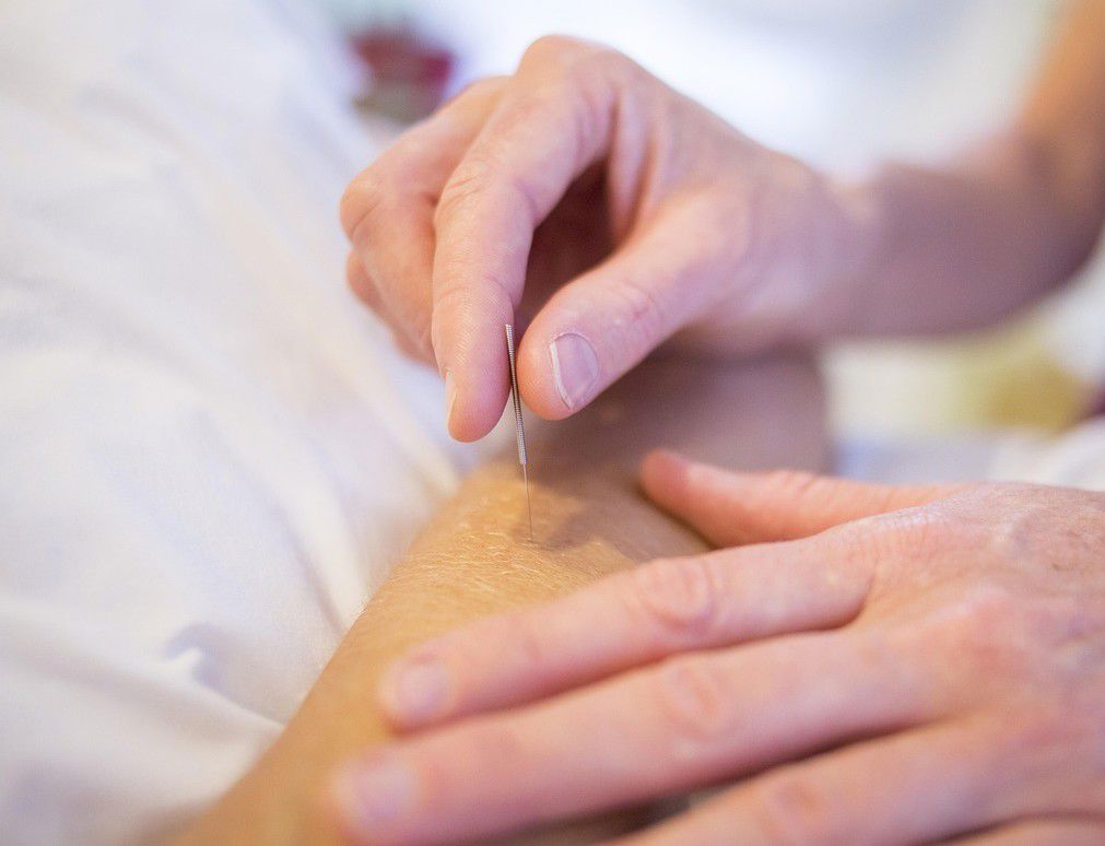 5Petalpics Acupuncture 5126777 1280